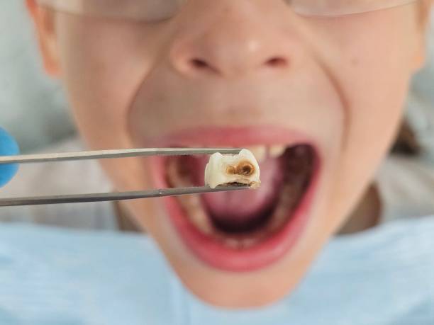 Best Mobile Emergency Dentist in Anderson, MO